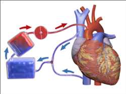 Artificial Heart-Lung Machine
