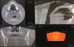 Cone Beam Computed Tomography (CBCT)